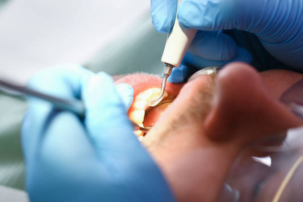Best Holiday Emergency Dentist in Dulles Town Center, VA