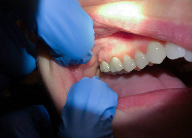Best Emergency Cosmetic Dentistry in Dulles Town Center, VA